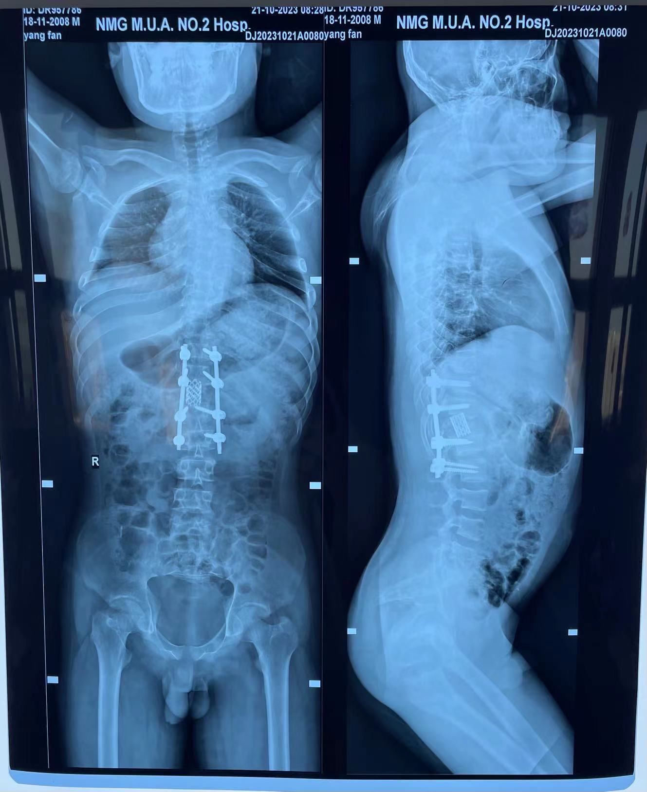 1698741555746079211.jpg 1698741555746079211.jpg