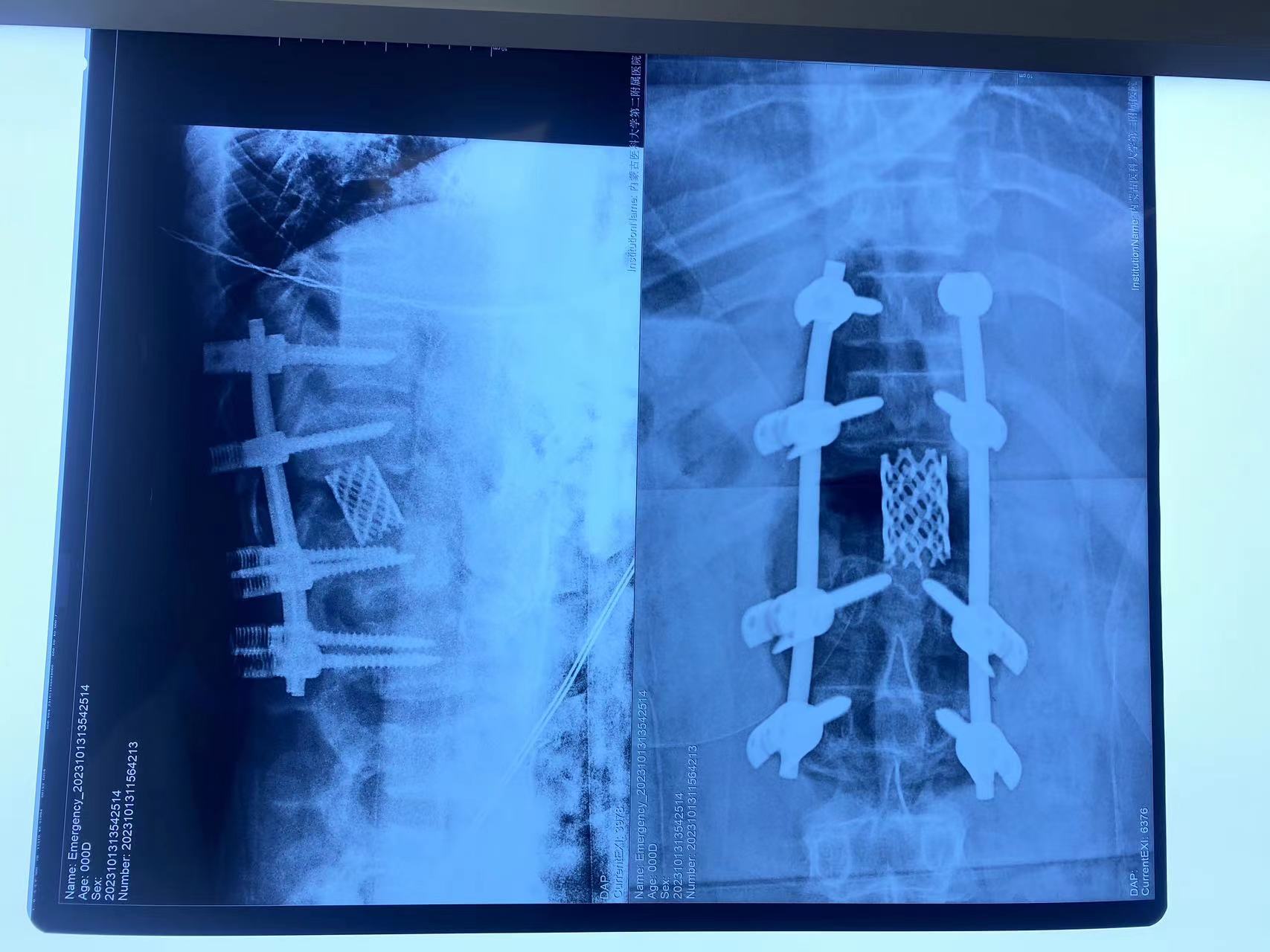 1698741555774041095.jpg 1698741555774041095.jpg